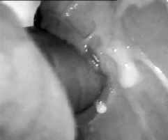 Tasty treat