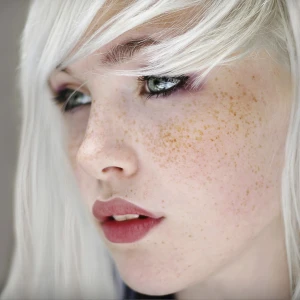 White Hair and Green Eyes