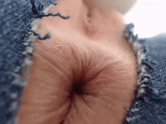 A twitching anus