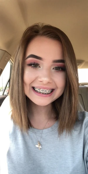 aluraye